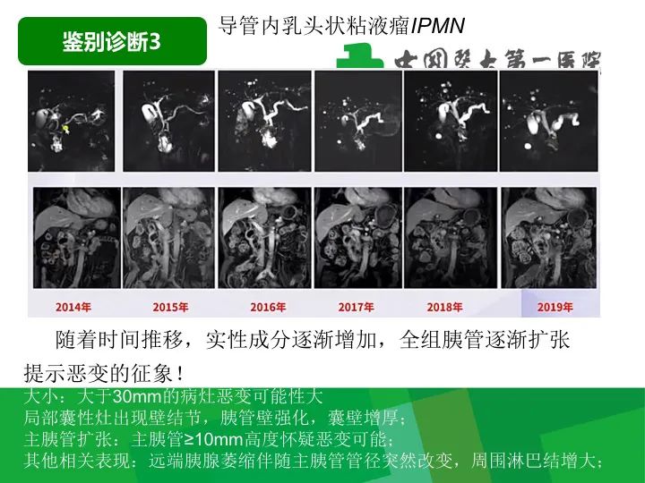 影像PPT - 【病例】胰腺实性假乳头状瘤1例CT及MR影像-40