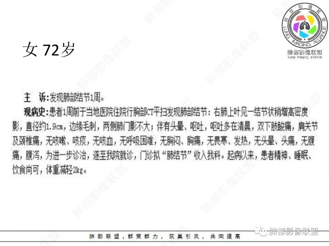 影像PPT - 【病例】孤立结节辨良恶,寻找细节定乾坤!-1 影像PPT - 【病例】孤立结节辨良恶,寻找细节定乾坤!-1