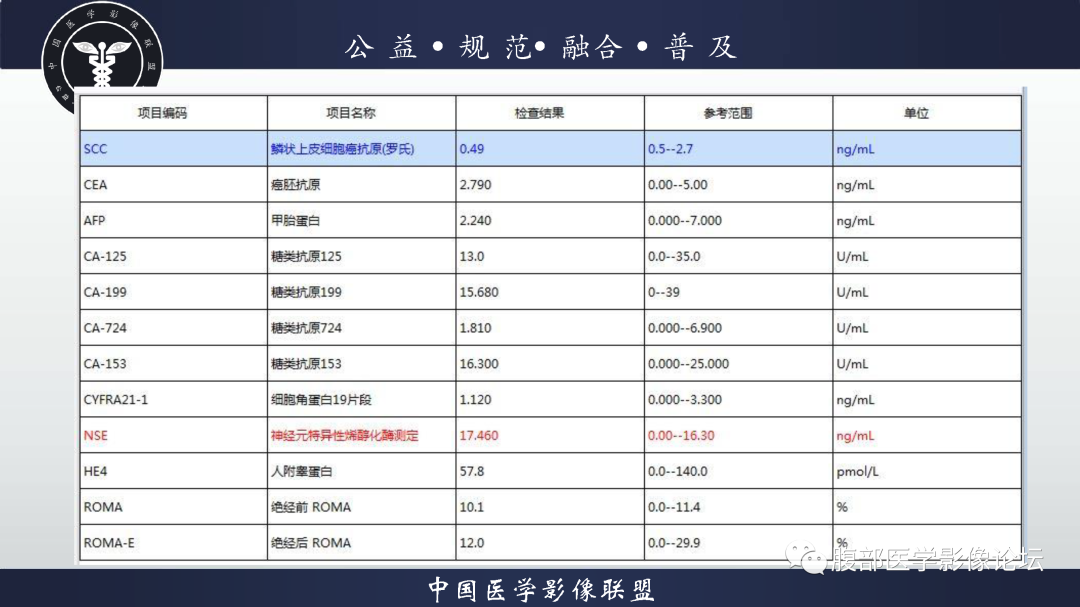影像PPT - 【病例】腹膜后边缘区淋巴瘤1例CT影像-3