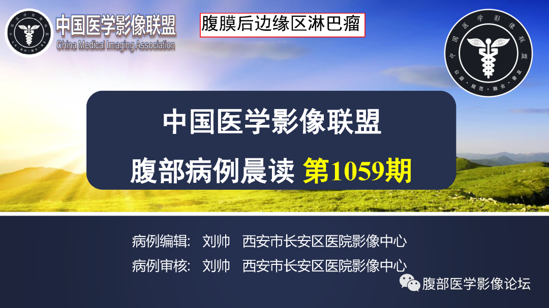 影像PPT - 【病例】腹膜后边缘区淋巴瘤1例CT影像-1