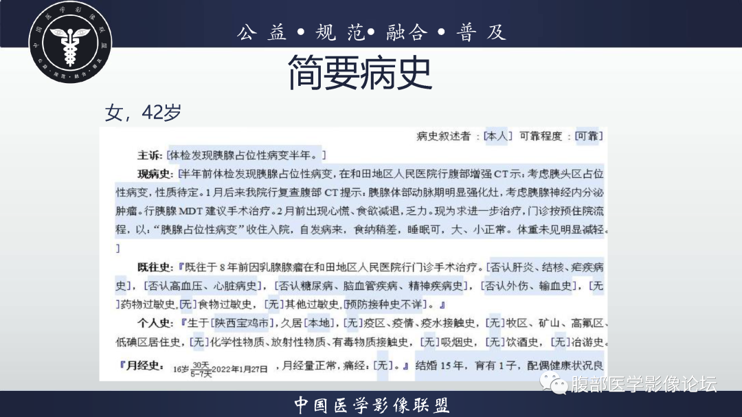 影像PPT - 【病例】腹膜后边缘区淋巴瘤1例CT影像-2