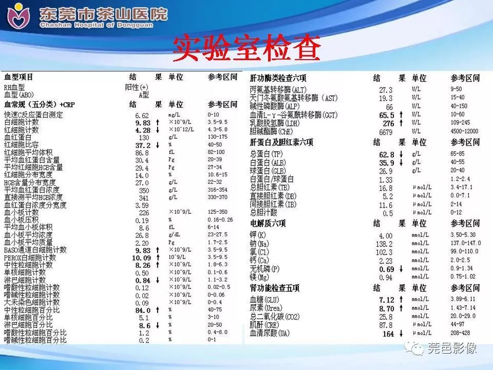 影像PPT - 【PPT】腹茧症的影像诊断-4