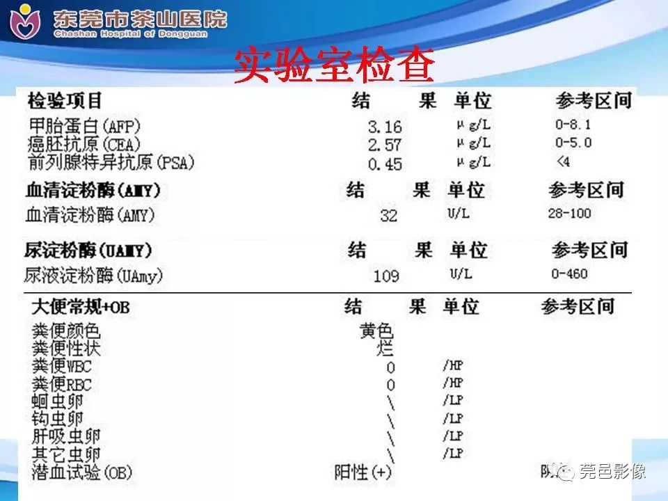 影像PPT - 【PPT】腹茧症的影像诊断-5