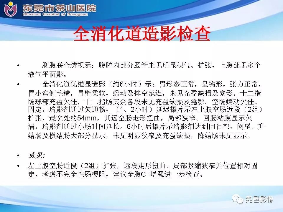 影像PPT - 【PPT】腹茧症的影像诊断-9