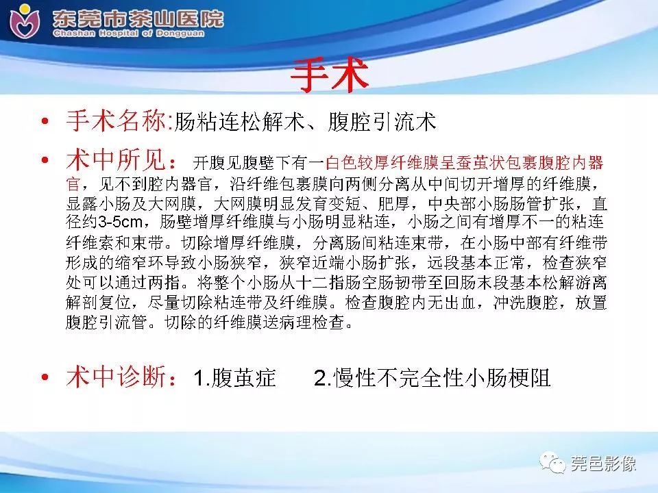 影像PPT - 【PPT】腹茧症的影像诊断-19