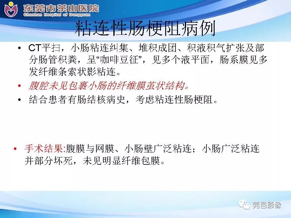 影像PPT - 【PPT】腹茧症的影像诊断-52