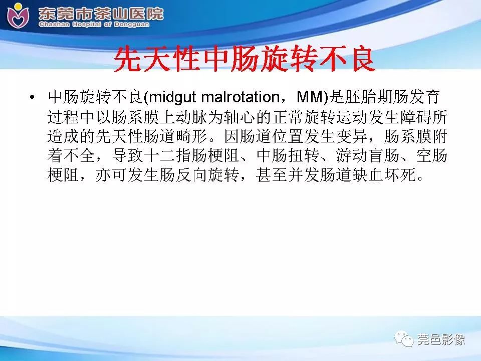 影像PPT - 【PPT】腹茧症的影像诊断-53