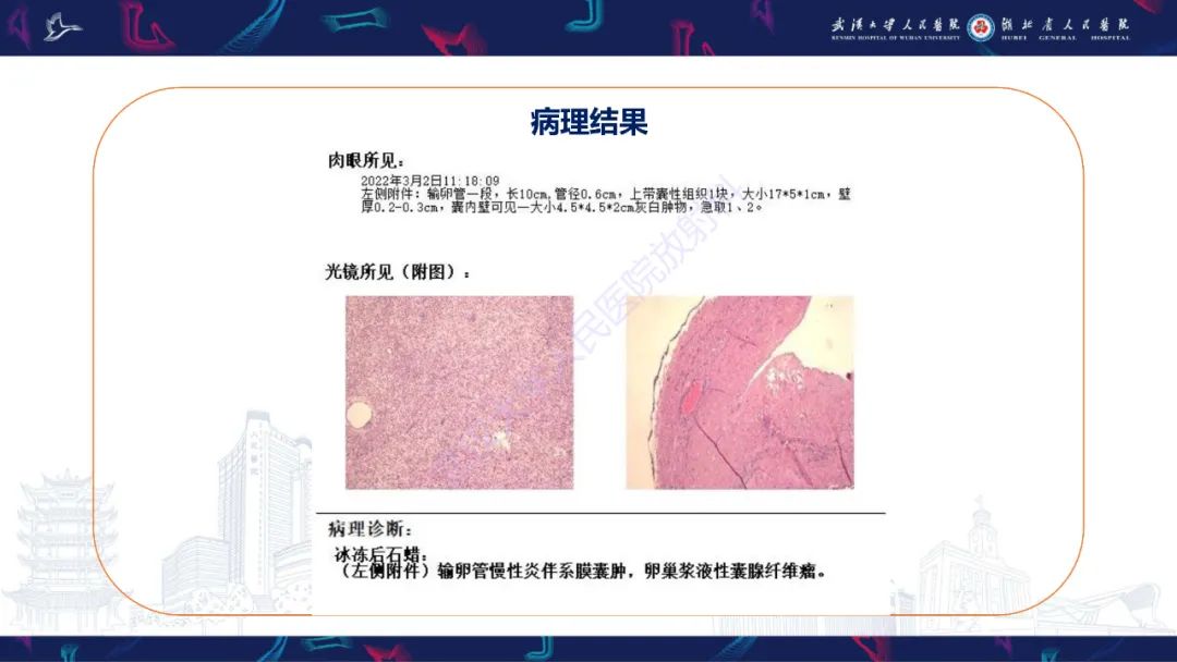 影像PPT - 【PPT】盆腹腔巨大占位性病变影像诊断-5