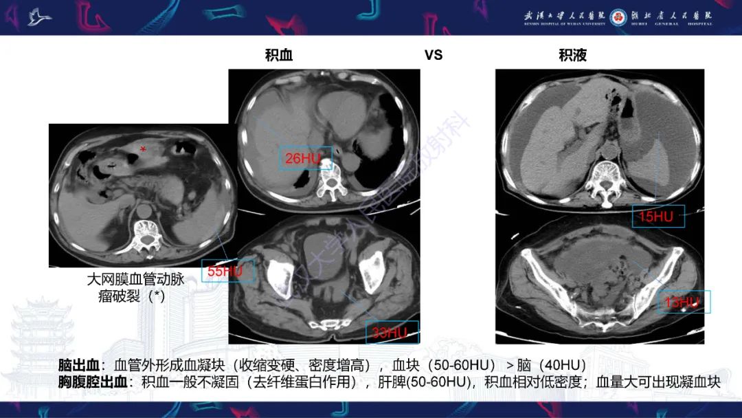 影像PPT - 【PPT】盆腹腔巨大占位性病变影像诊断-11