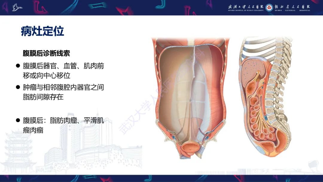 影像PPT - 【PPT】盆腹腔巨大占位性病变影像诊断-42