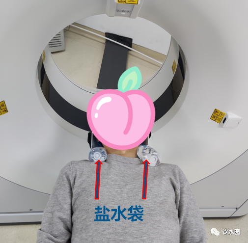 影像PPT - 盐水袋可去除射线束硬化伪影-1