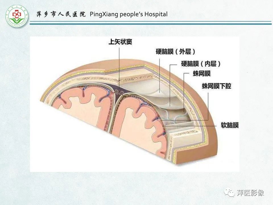 影像PPT - 【PPT】脑出血的分类及相关影像学表现-3