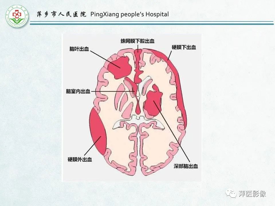 影像PPT - 【PPT】脑出血的分类及相关影像学表现-5
