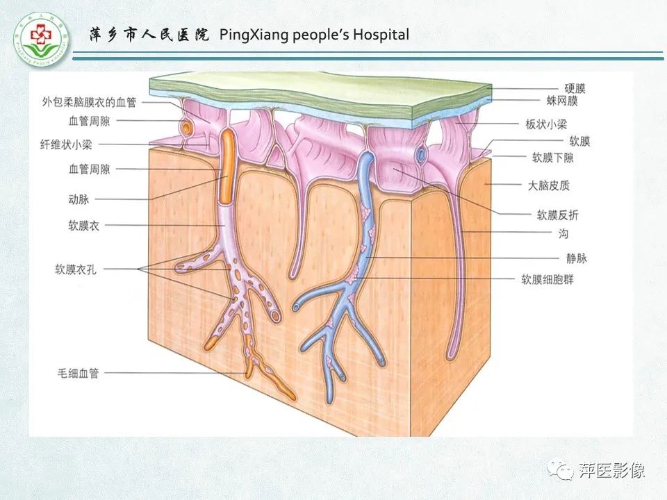 影像PPT - 【PPT】脑出血的分类及相关影像学表现-4