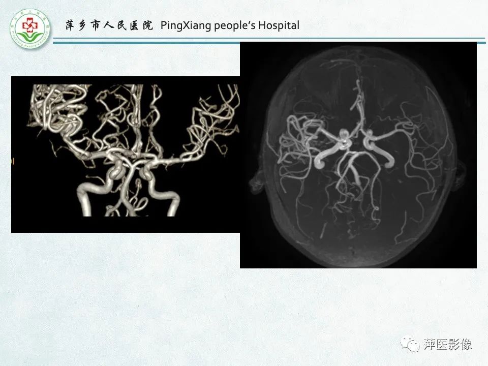影像PPT - 【PPT】脑出血的分类及相关影像学表现-39
