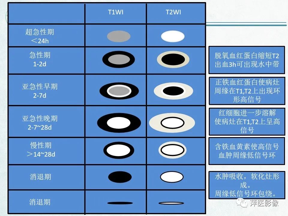 影像PPT - 【PPT】脑出血的分类及相关影像学表现-44