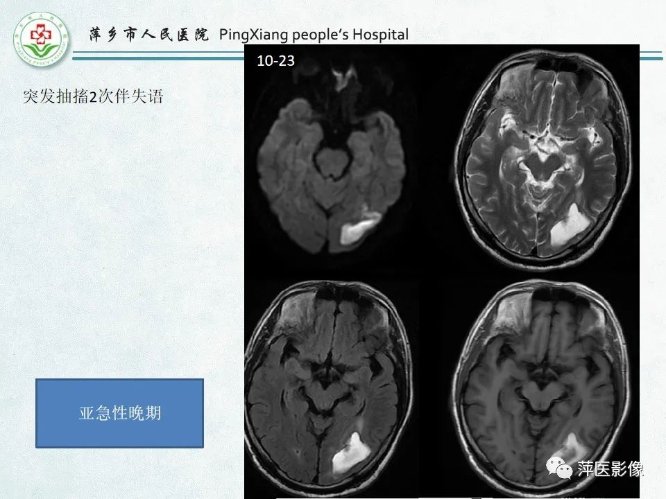 影像PPT - 【PPT】脑出血的分类及相关影像学表现-48