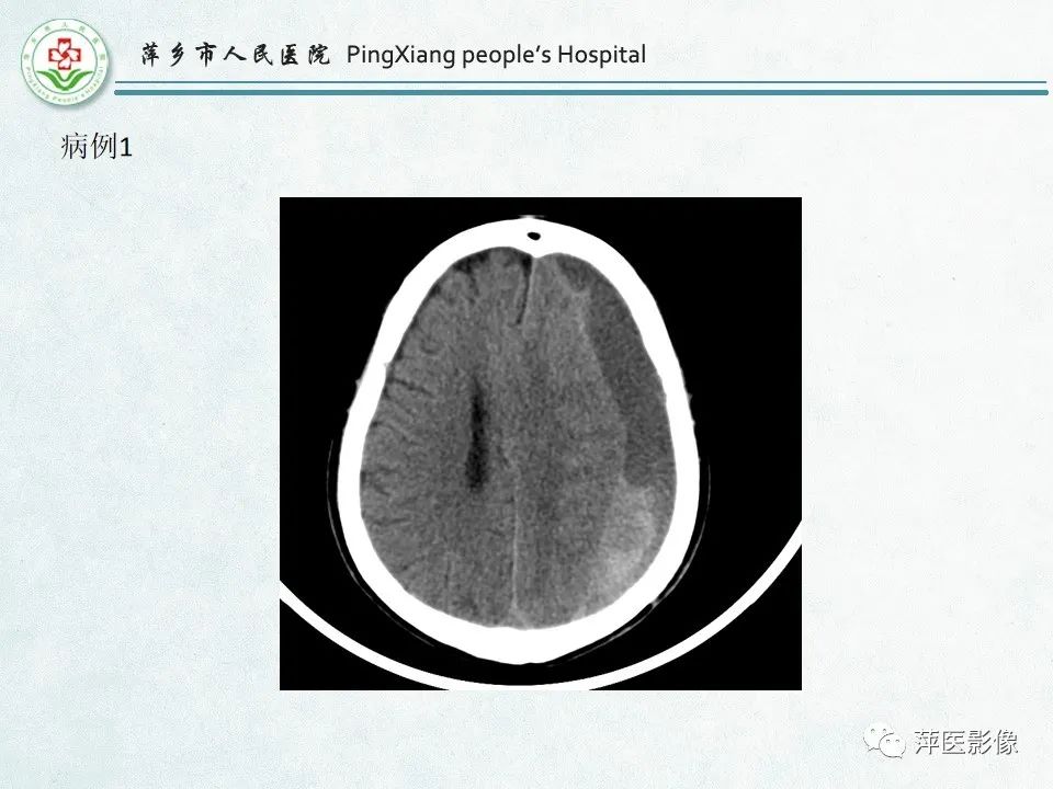 影像PPT - 【PPT】脑出血的分类及相关影像学表现-52