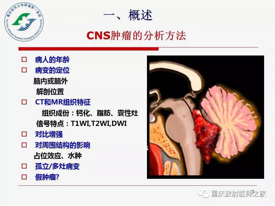 影像PPT - 【PPT】中枢神经系统肿瘤影像学诊断思路-3