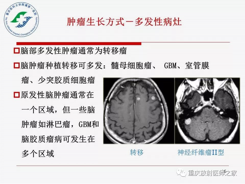 影像PPT - 【PPT】中枢神经系统肿瘤影像学诊断思路-16