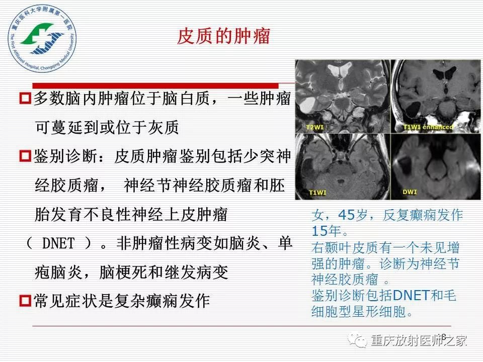 影像PPT - 【PPT】中枢神经系统肿瘤影像学诊断思路-18