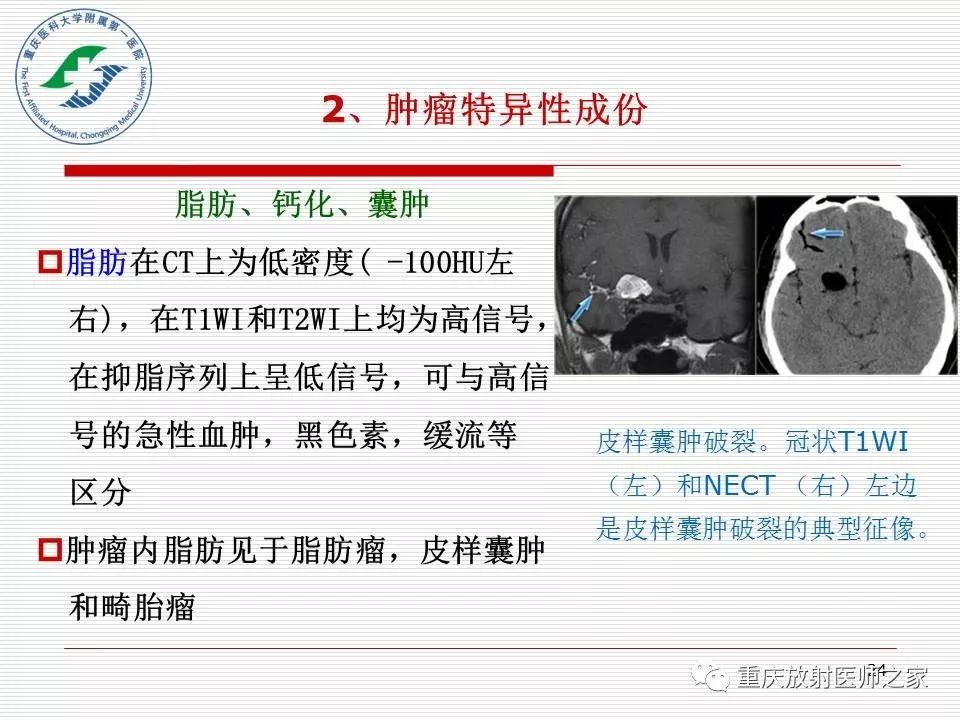 影像PPT - 【PPT】中枢神经系统肿瘤影像学诊断思路-24