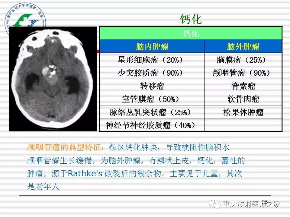 影像PPT - 【PPT】中枢神经系统肿瘤影像学诊断思路-25