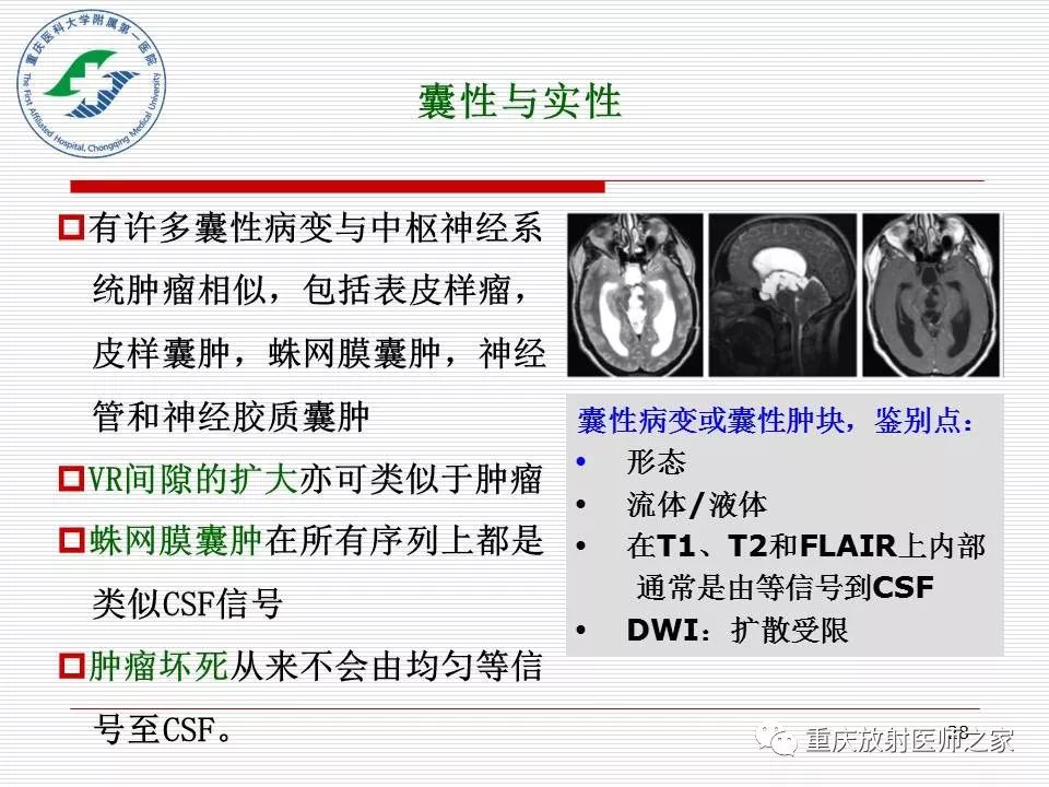 影像PPT - 【PPT】中枢神经系统肿瘤影像学诊断思路-28
