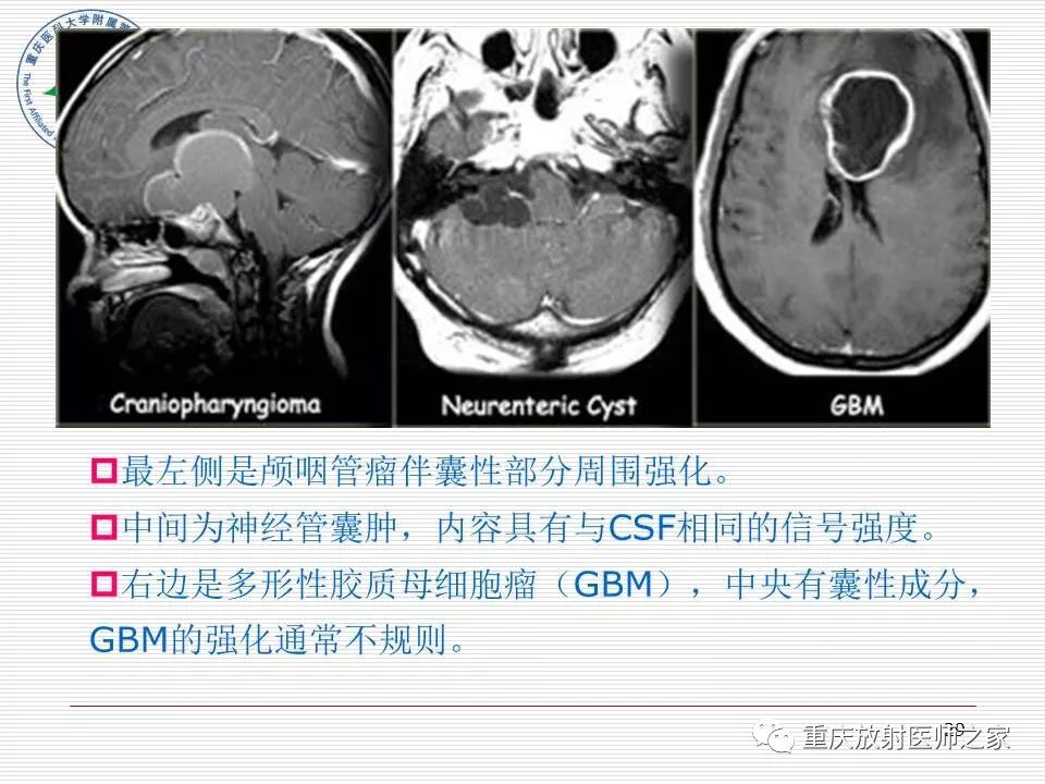 影像PPT - 【PPT】中枢神经系统肿瘤影像学诊断思路-29
