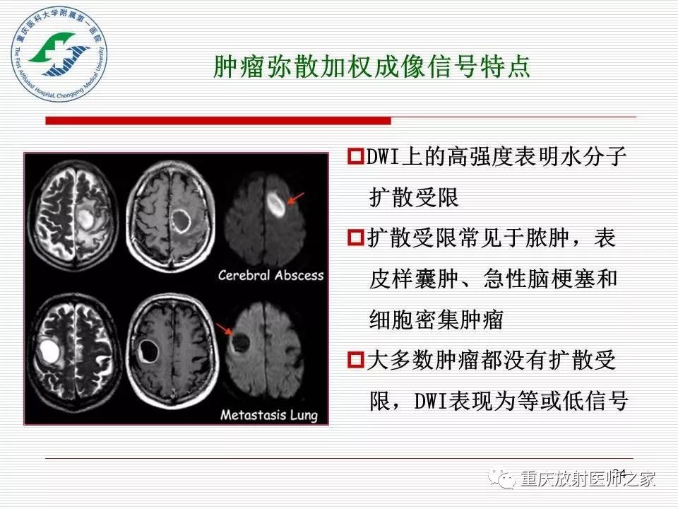 影像PPT - 【PPT】中枢神经系统肿瘤影像学诊断思路-34