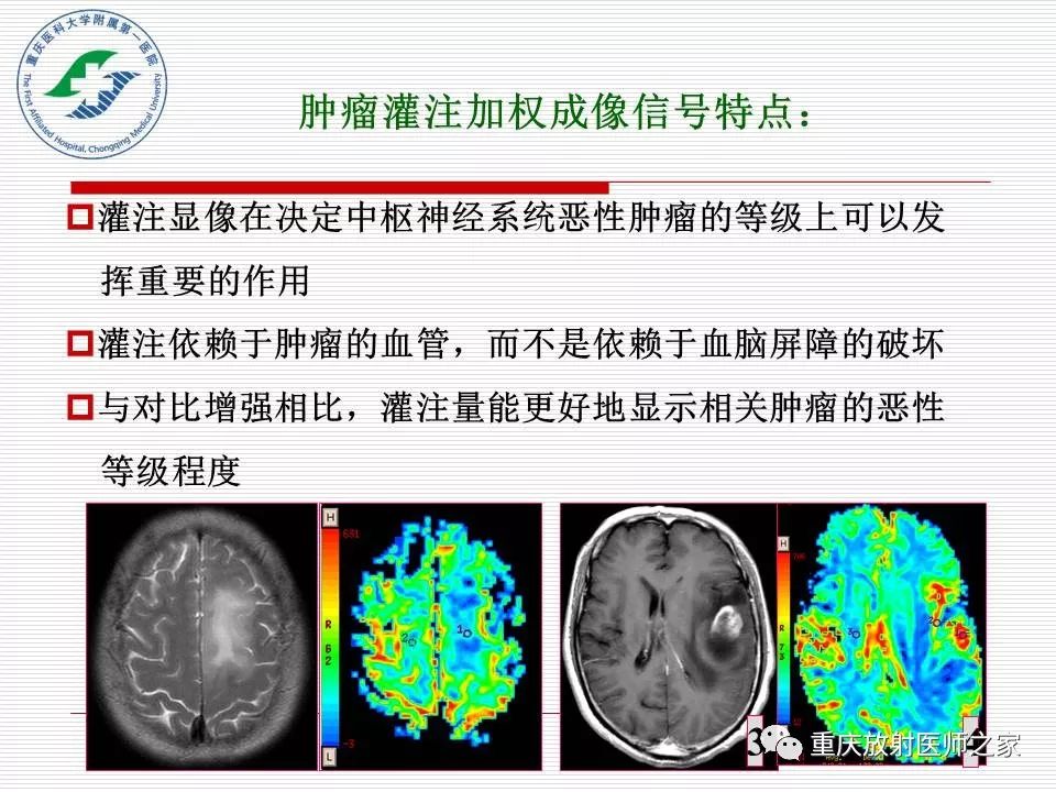 影像PPT - 【PPT】中枢神经系统肿瘤影像学诊断思路-35