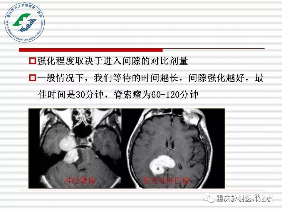 影像PPT - 【PPT】中枢神经系统肿瘤影像学诊断思路-39