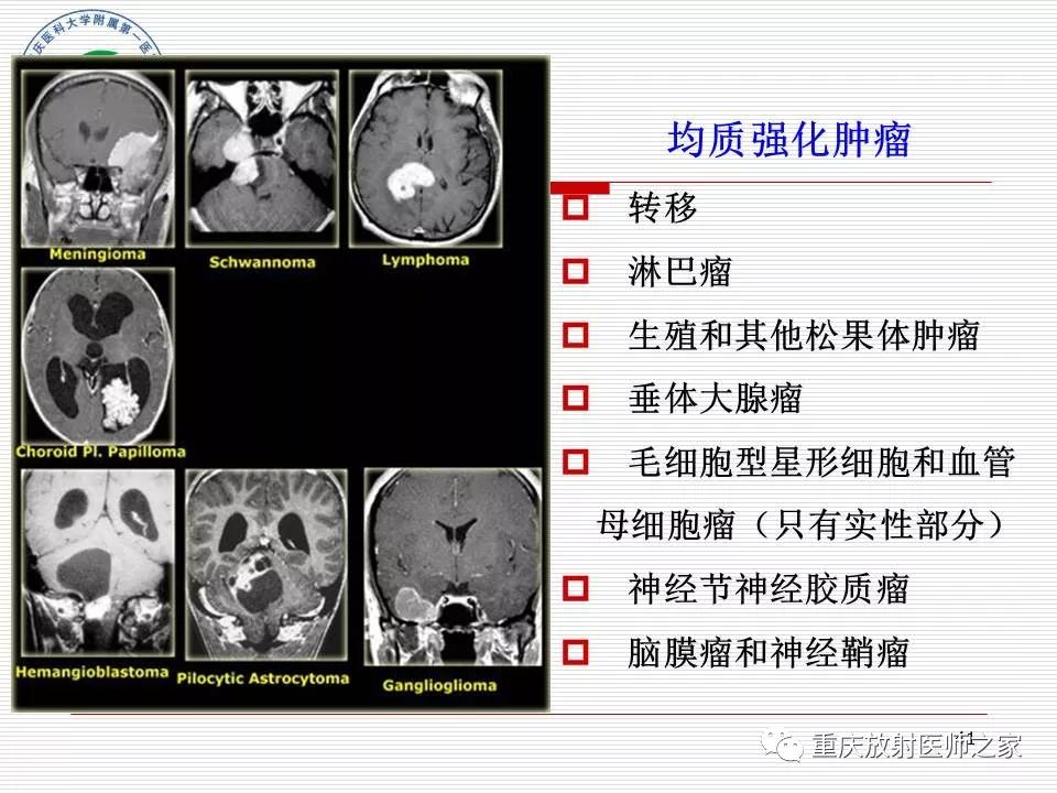 影像PPT - 【PPT】中枢神经系统肿瘤影像学诊断思路-41
