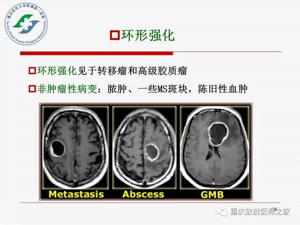 影像PPT - 【PPT】中枢神经系统肿瘤影像学诊断思路-44