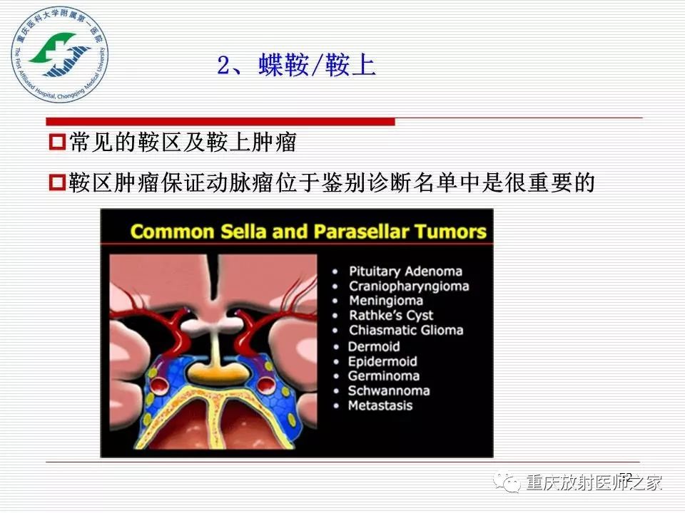 影像PPT - 【PPT】中枢神经系统肿瘤影像学诊断思路-52