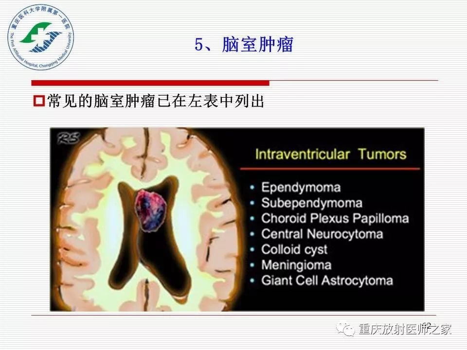 影像PPT - 【PPT】中枢神经系统肿瘤影像学诊断思路-62