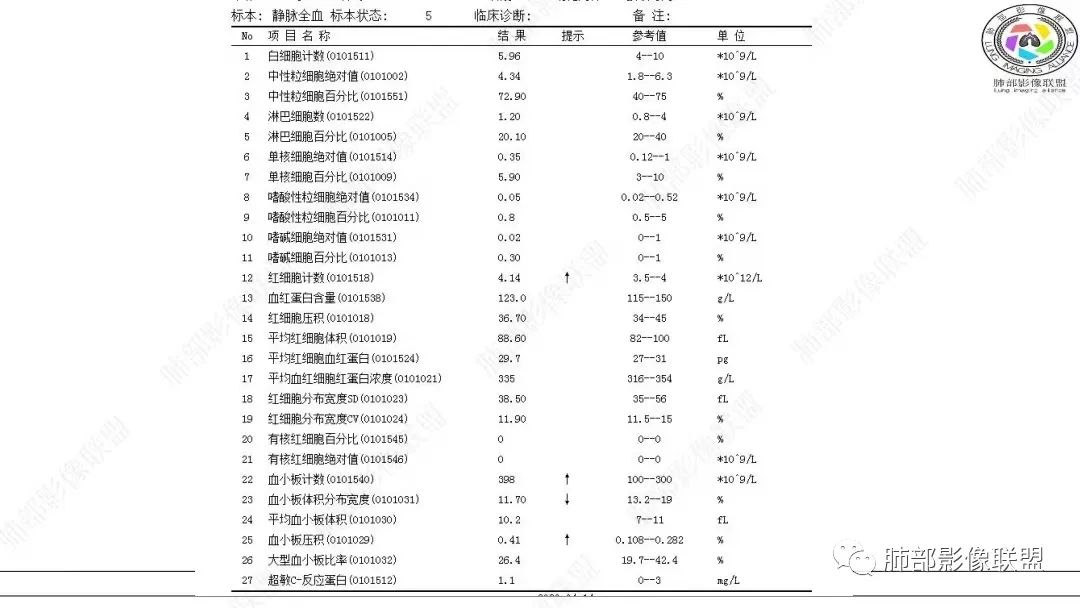 影像PPT - 【病例】肺淋巴上皮瘤样癌1例CT影像-3