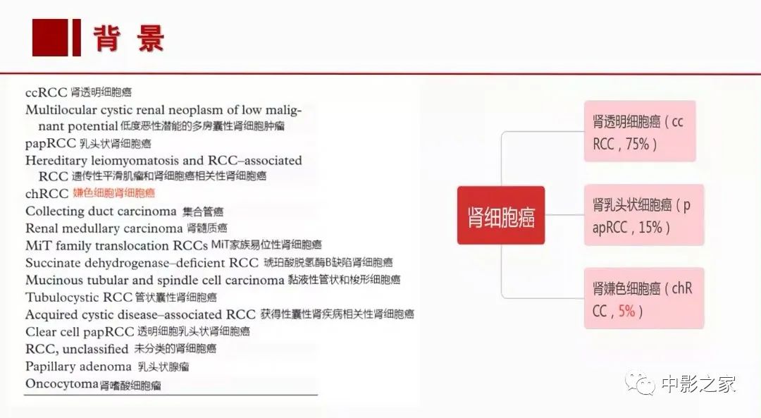 影像PPT - 【PPT】肾嫌色细胞癌影像诊断、鉴别、分级与预后评估-5