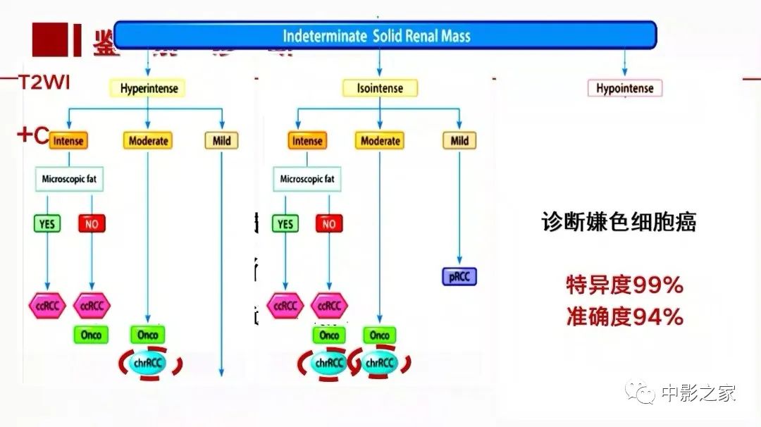 影像PPT - 【PPT】肾嫌色细胞癌影像诊断、鉴别、分级与预后评估-45