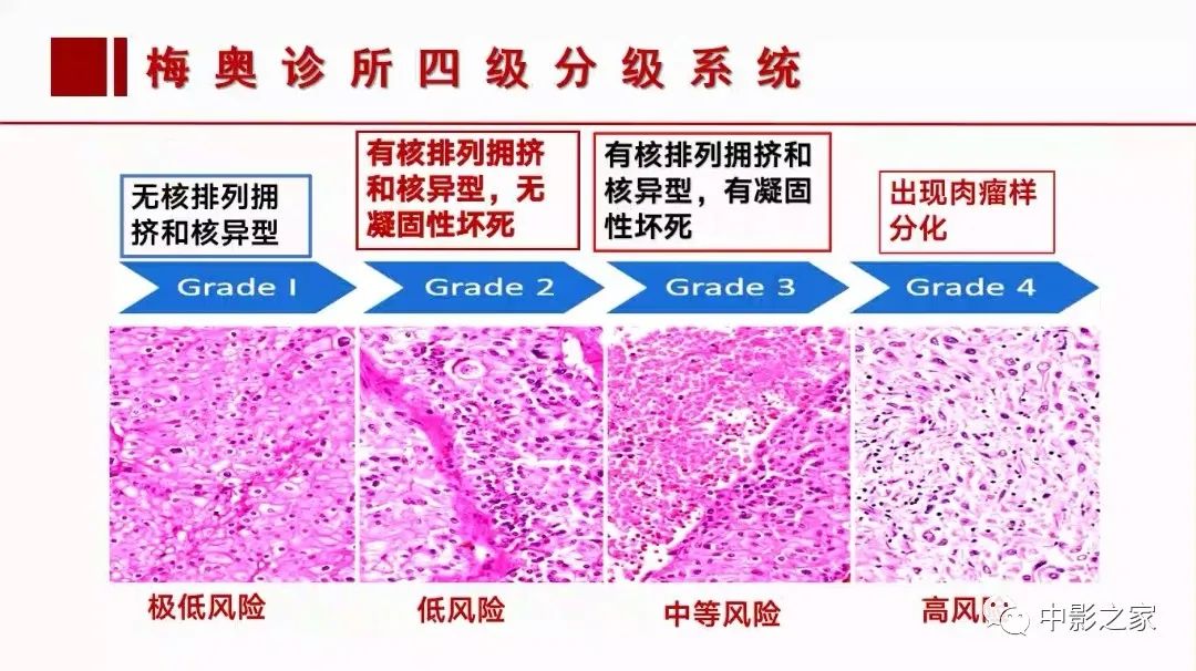 影像PPT - 【PPT】肾嫌色细胞癌影像诊断、鉴别、分级与预后评估-53