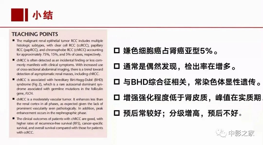 影像PPT - 【PPT】肾嫌色细胞癌影像诊断、鉴别、分级与预后评估-1