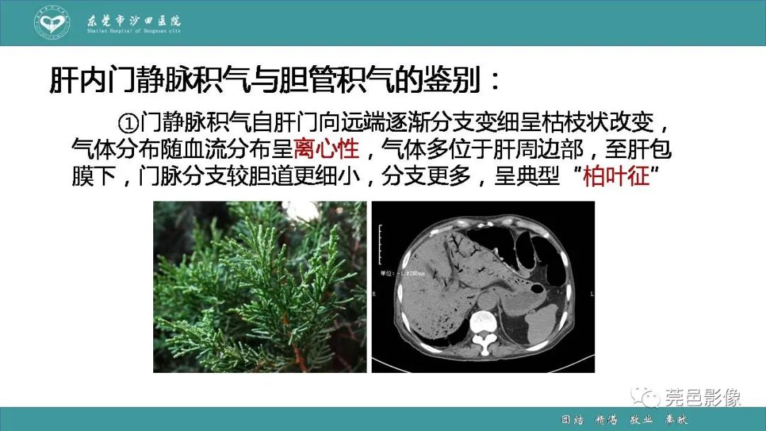 影像PPT - 【PPT】1例肠缺血坏死伴门静脉积气的CT诊断-34