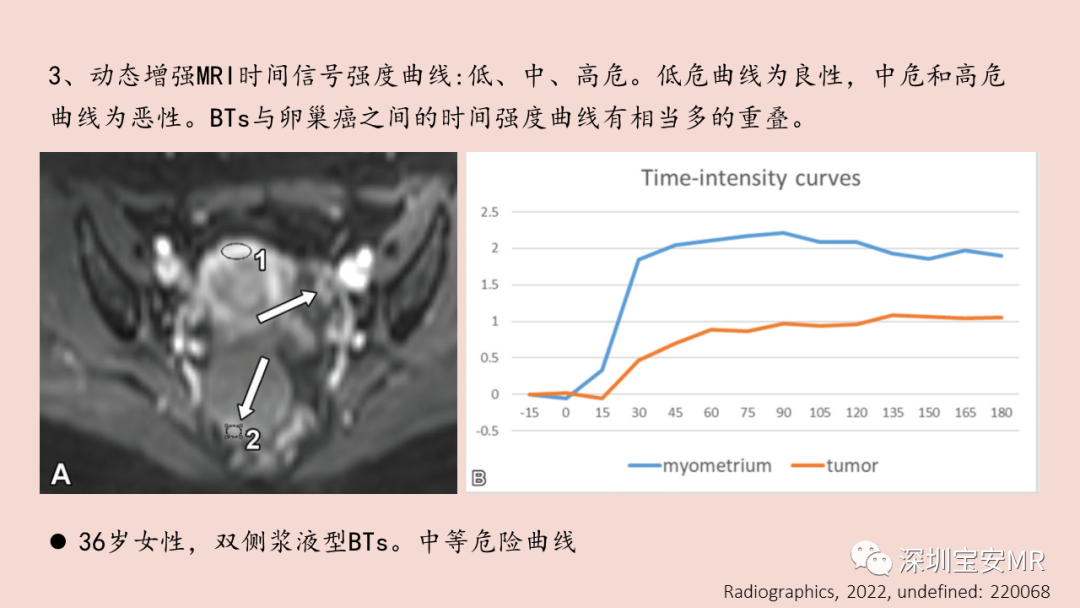 影像PPT - 【PPT】卵巢交界性上皮性肿瘤MRI与病理对照-17