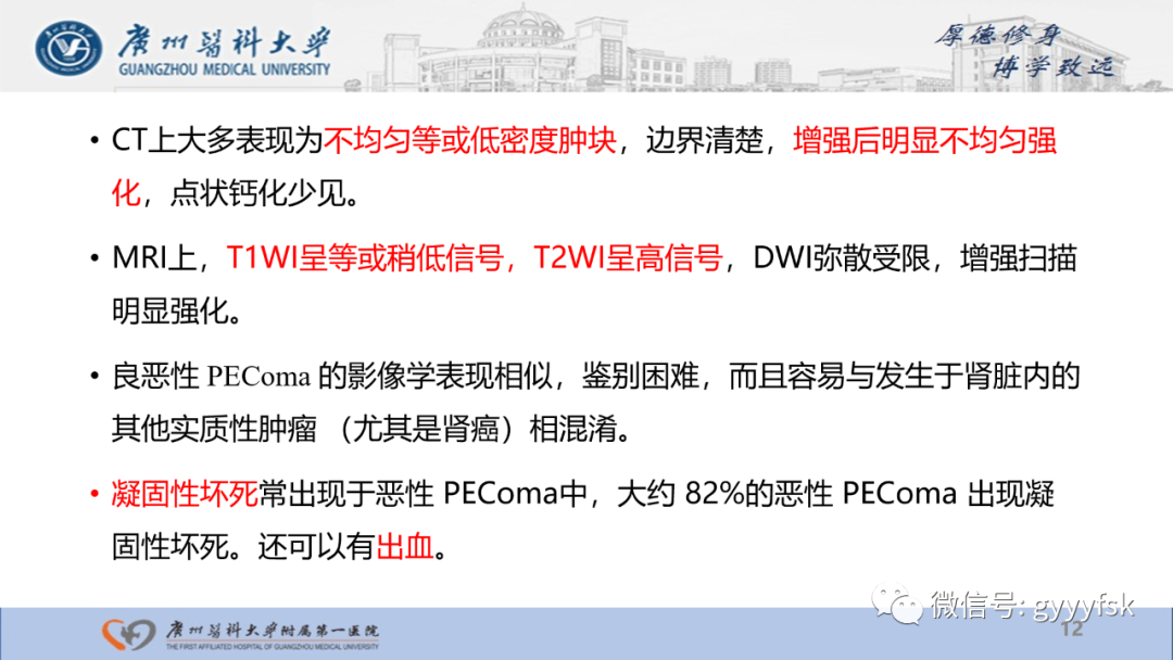 影像PPT - 【PPT】肾少见肿瘤影像诊断的文献汇报-12