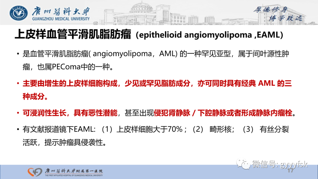 影像PPT - 【PPT】肾少见肿瘤影像诊断的文献汇报-17