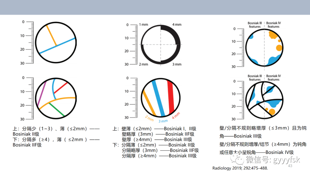 影像PPT - 【PPT】肾少见肿瘤影像诊断的文献汇报-43