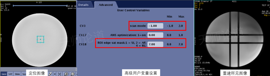 影像PPT - 磁共振波谱成像基本概念与参数解读-10 影像PPT - 磁共振波谱成像基本概念与参数解读-10