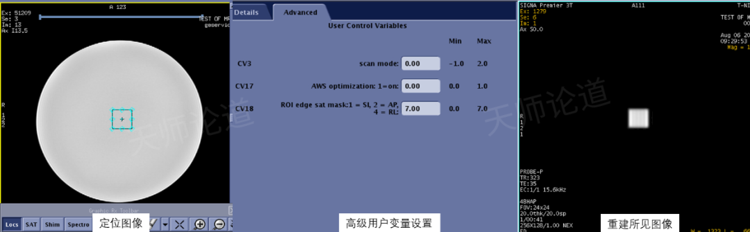 影像PPT - 磁共振波谱成像基本概念与参数解读-11 影像PPT - 磁共振波谱成像基本概念与参数解读-11