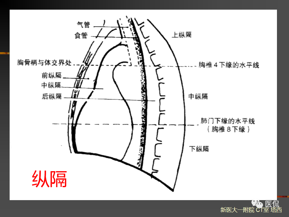 影像PPT - 【PPT】呼吸系统常见疾病影像诊断-7