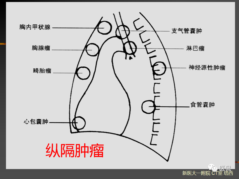 影像PPT - 【PPT】呼吸系统常见疾病影像诊断-32